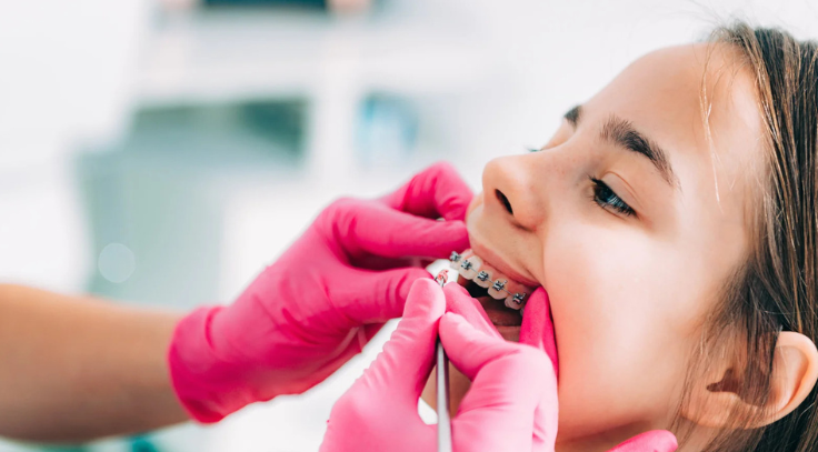 Early orthodontic care for kids ensures proper teeth alignment, jaw growth, and healthy smiles.