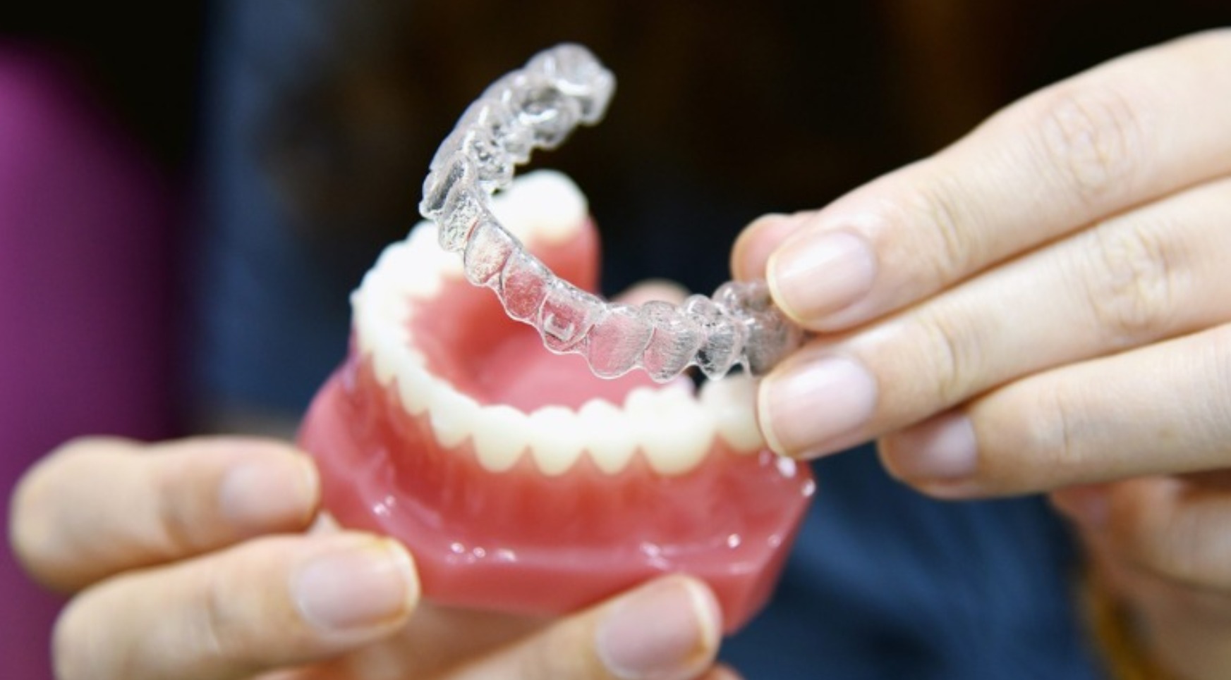 Why Do Teenagers Prefer Clear Aligners For Teeth Straightening